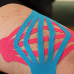 Image of therapeutic tools, kinesiology taping strategies
